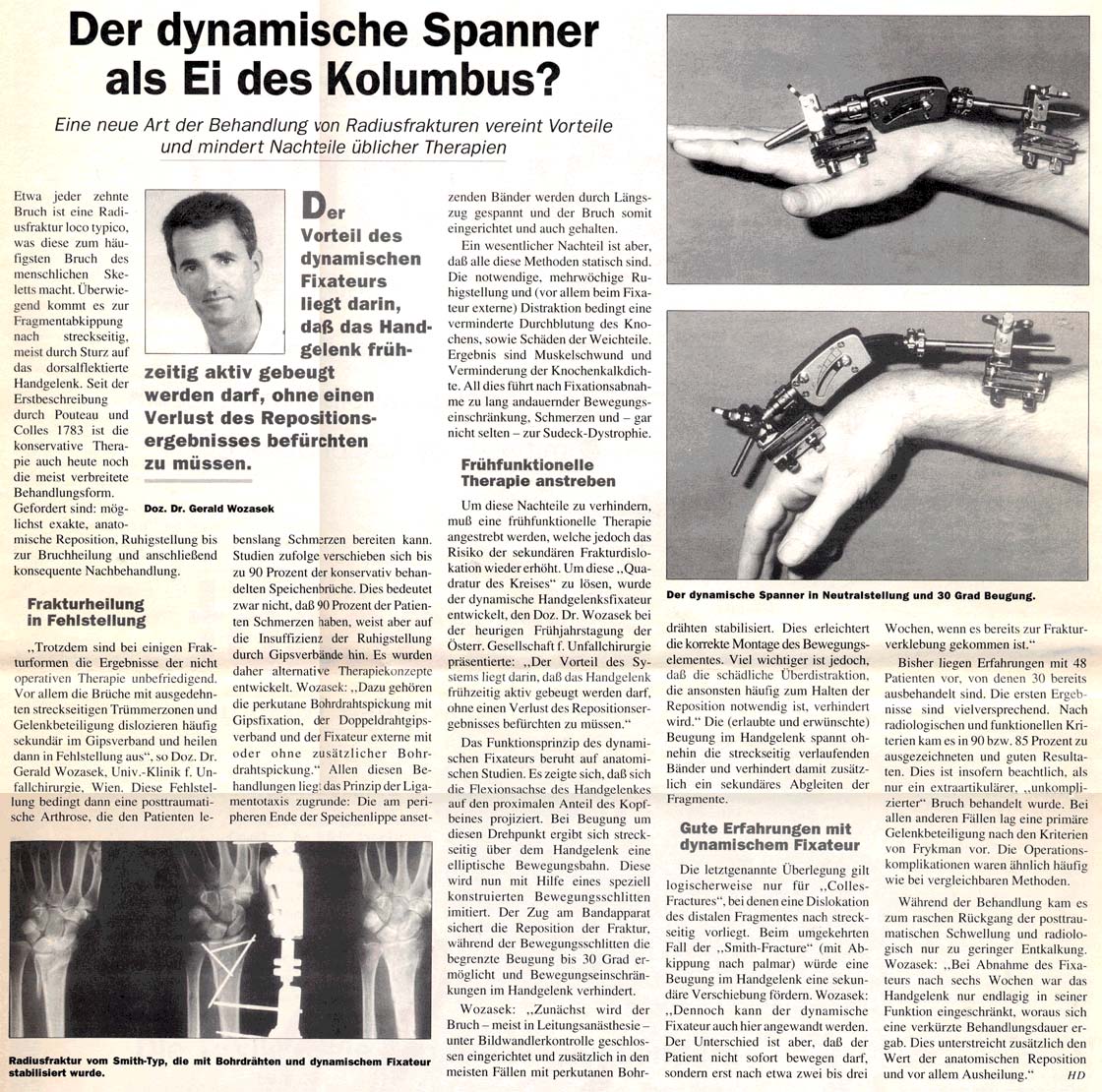 Der dynamische Spanner als Ei des Kolumbus?