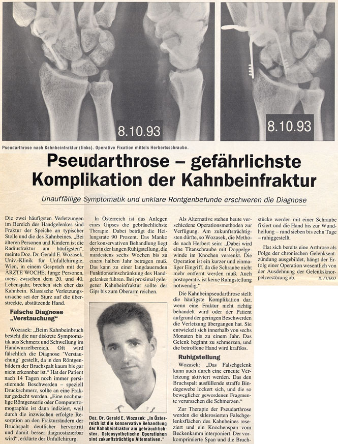 Pseudoarthrose - gefährlichste Komplikation der Kahnbeinfraktur