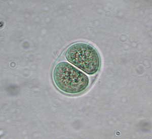 Chroocuccus limneticus Kugelblaualge