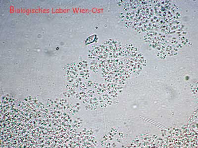 Microcystis Netzblaualge