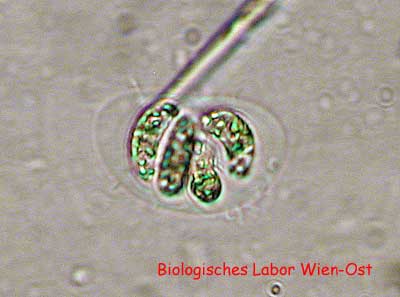 Nephrochlamys Sichelzellen-Grünalge